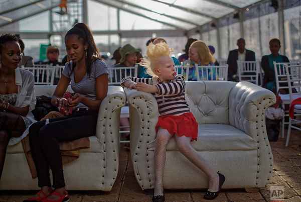 Первый в мире конкурс красоты альбиносов проводится в Кении